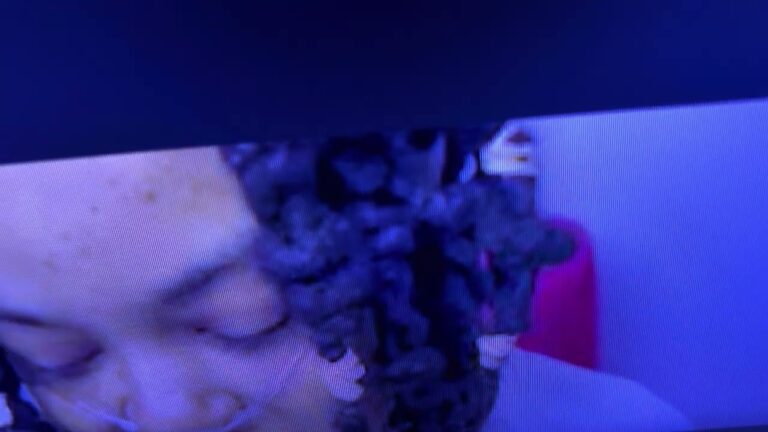 FRATERNITIES NEED TO BE MONITORED ! NAACP LIFELONG MEMBERS WTF ANOTHER BLACK TEEN HAZED TO D &#TH